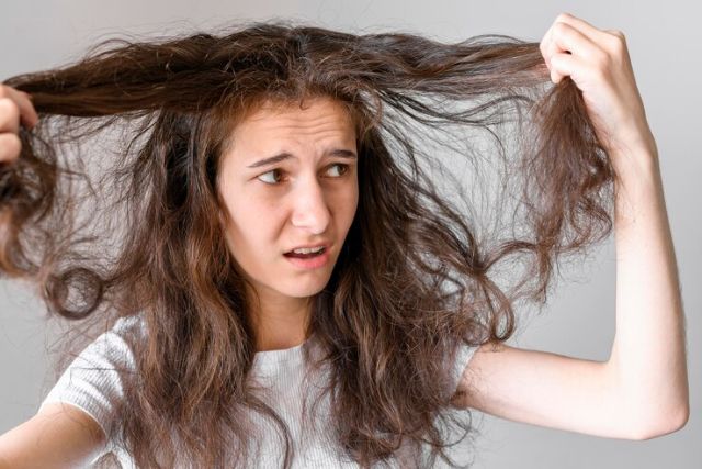 How To Manage Hair Loss Due To Stress And Anxiety And Its Treatment